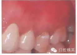 640.webp (4).jpg 640.webp (4).jpg