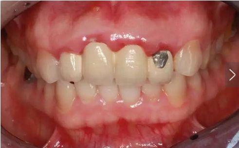 QQ圖片20161111165405.png QQ圖片20161111165405.png