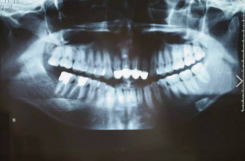 QQ圖片20161111165435.png QQ圖片20161111165435.png