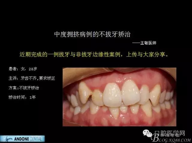 640.webp.jpg 640.webp.jpg