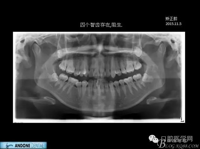 640.webp (4).jpg 640.webp (4).jpg