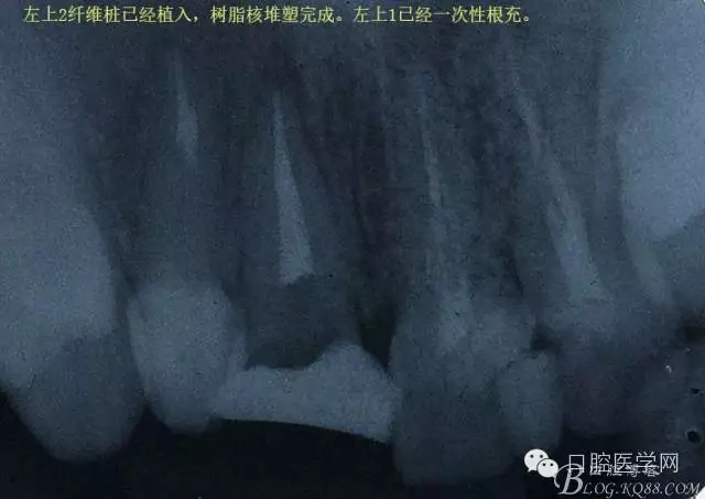 640.webp (1).jpg 640.webp (1).jpg