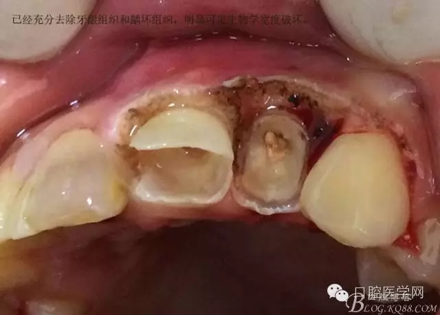 640.webp (7).jpg 640.webp (7).jpg