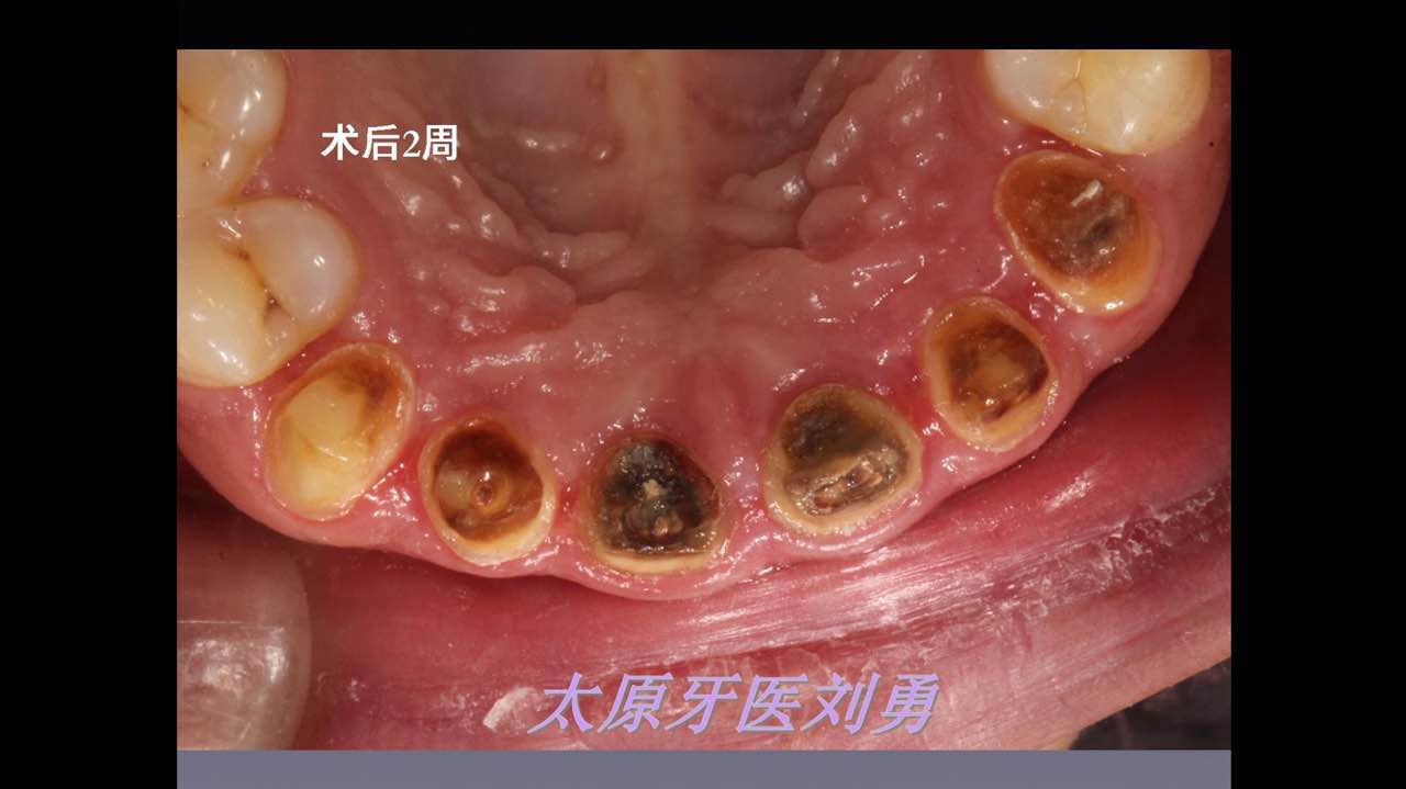 webwxgetmsgimg (5).jpg webwxgetmsgimg (5).jpg