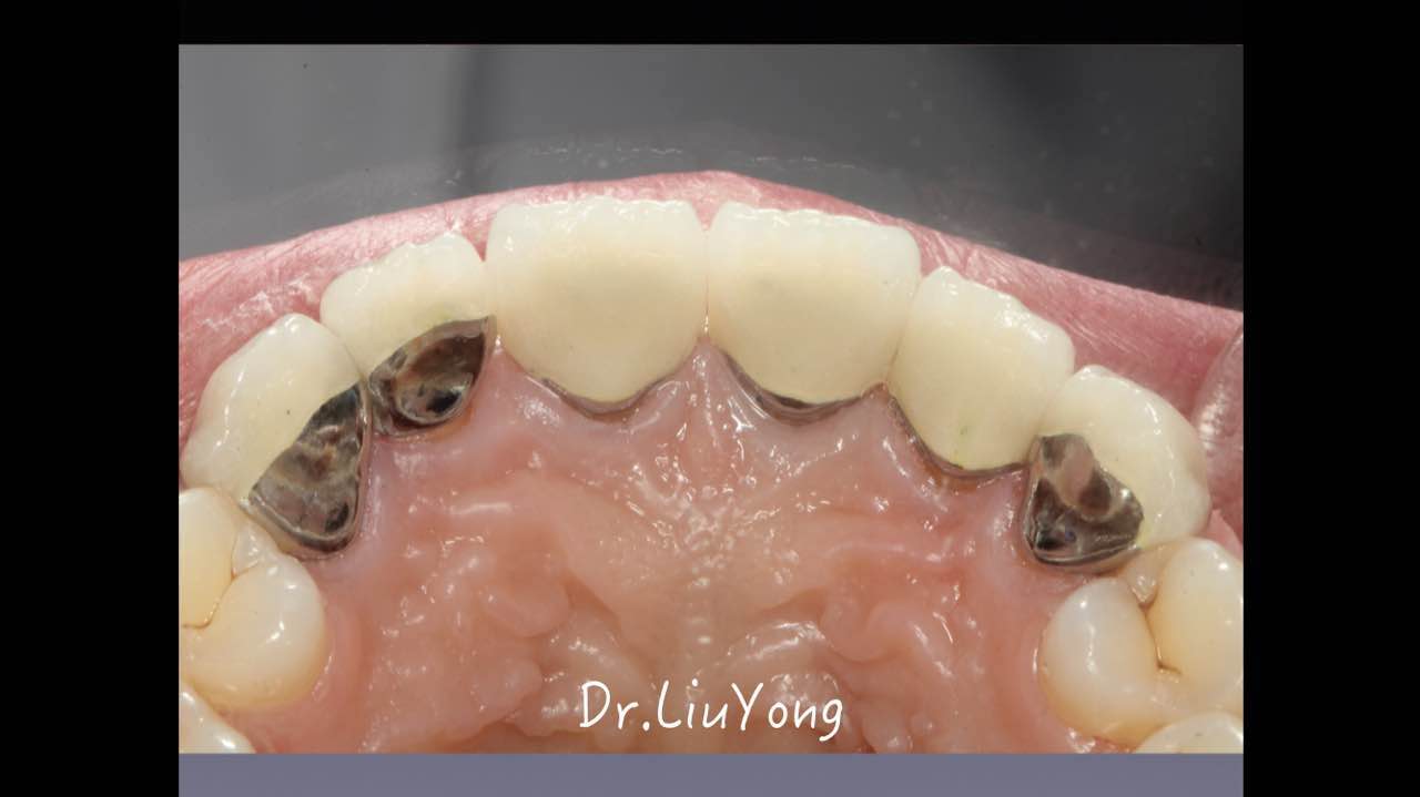 webwxgetmsgimg (7).jpg webwxgetmsgimg (7).jpg