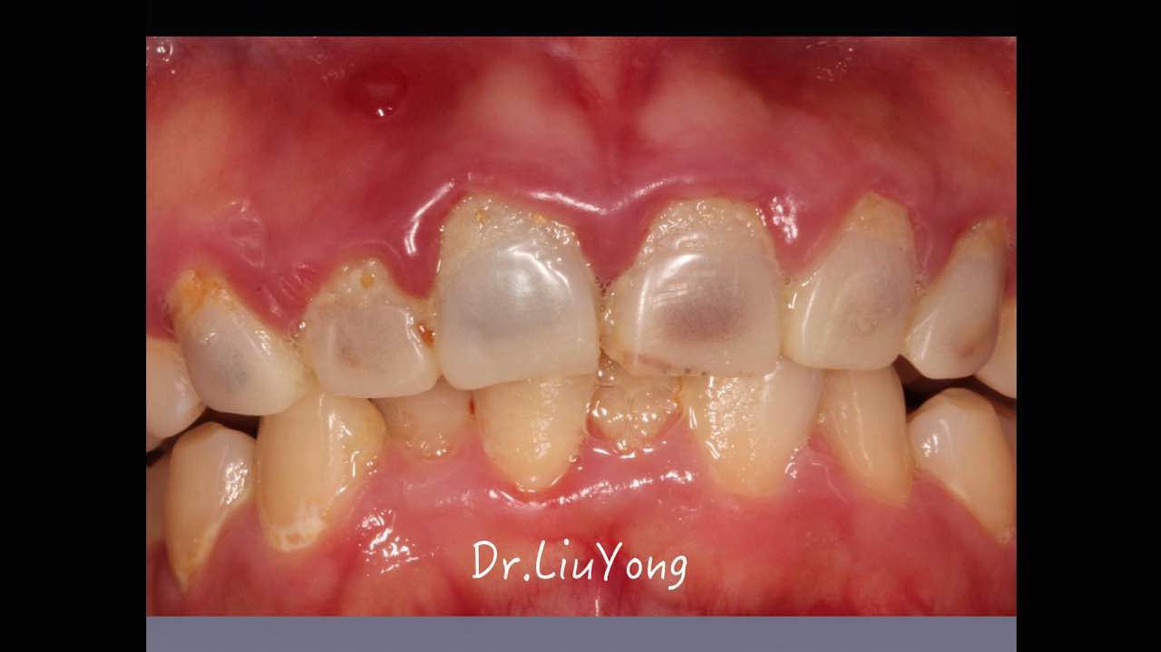 webwxgetmsgimg.jpg webwxgetmsgimg.jpg