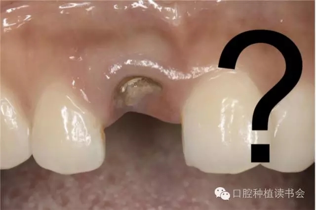 640.webp.jpg 640.webp.jpg