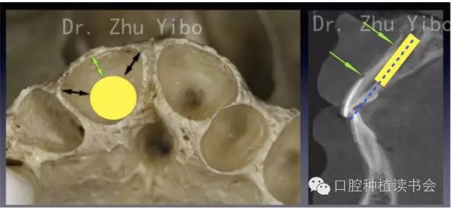 640.webp (2).jpg 640.webp (2).jpg