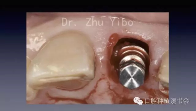 640.webp (4).jpg 640.webp (4).jpg