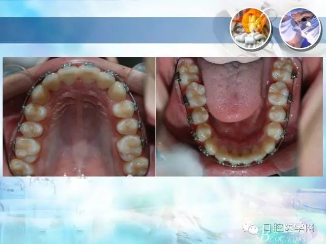 640.webp (33).jpg 640.webp (33).jpg