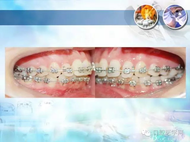 640.webp (62).jpg 640.webp (62).jpg