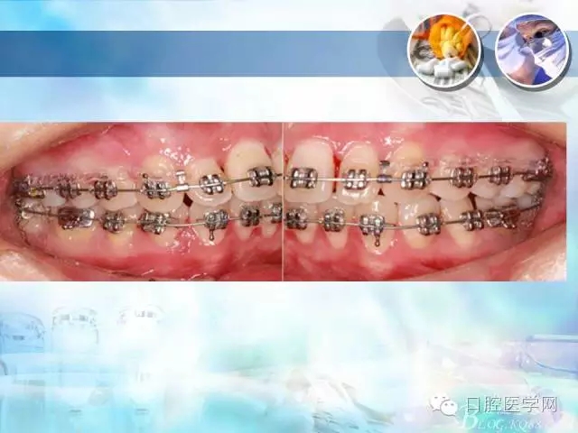 640.webp (71).jpg 640.webp (71).jpg