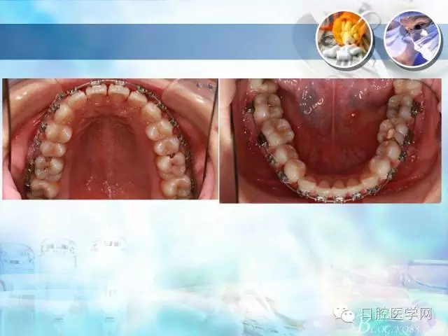 640.webp (72).jpg 640.webp (72).jpg