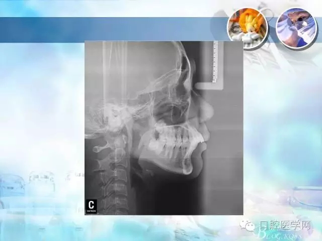 640.webp (78).jpg 640.webp (78).jpg