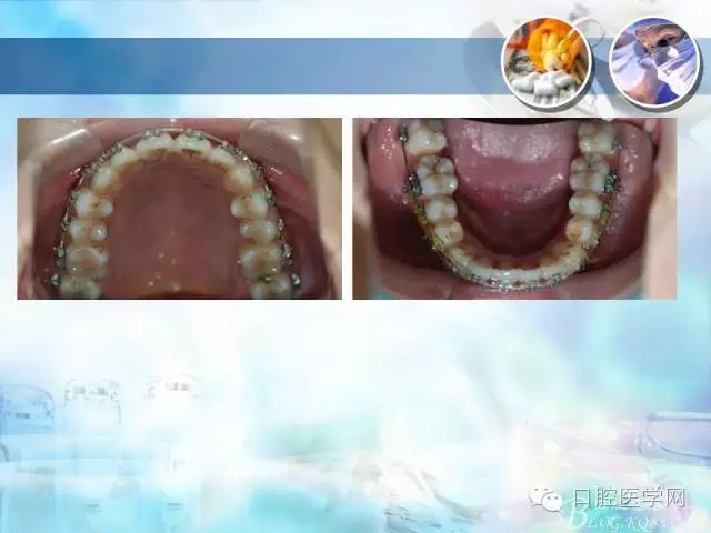 640.webp (90).jpg 640.webp (90).jpg