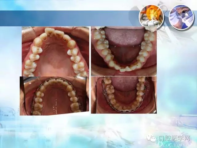 640.webp (96).jpg 640.webp (96).jpg