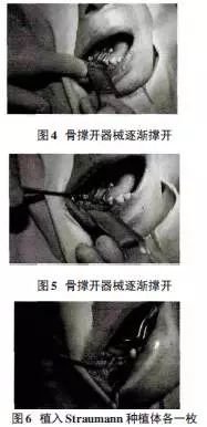 640.webp (5).jpg 640.webp (5).jpg