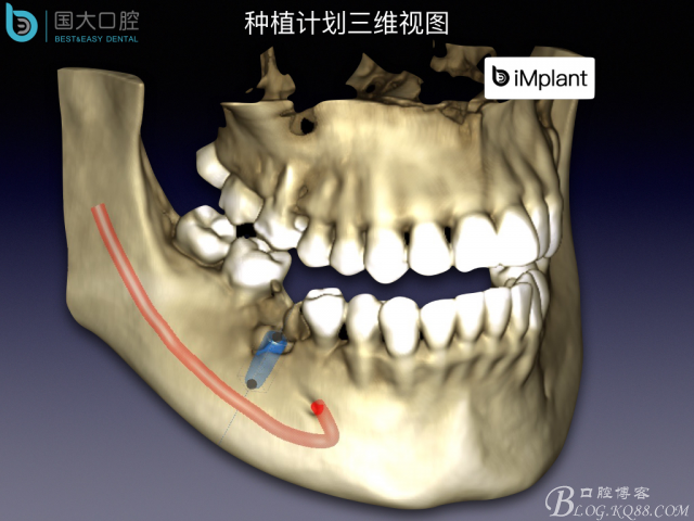 20160806124124_57322.jpeg 20160806124124_57322.jpeg