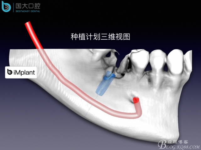 20160806124127_95058.jpeg 20160806124127_95058.jpeg