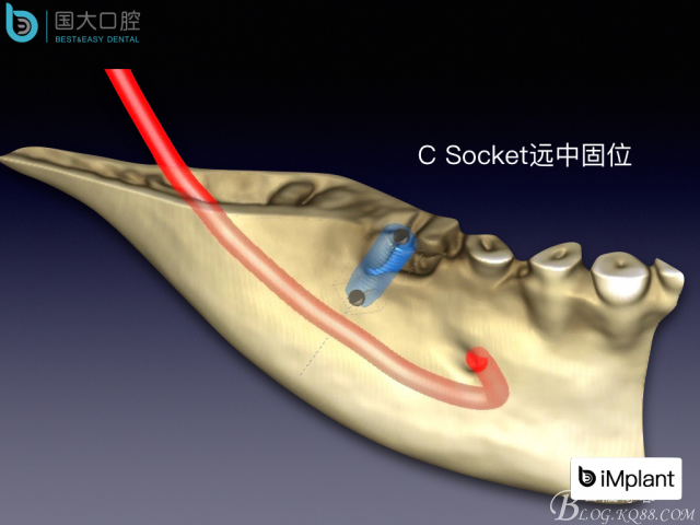 20160806124128_78269.jpeg 20160806124128_78269.jpeg