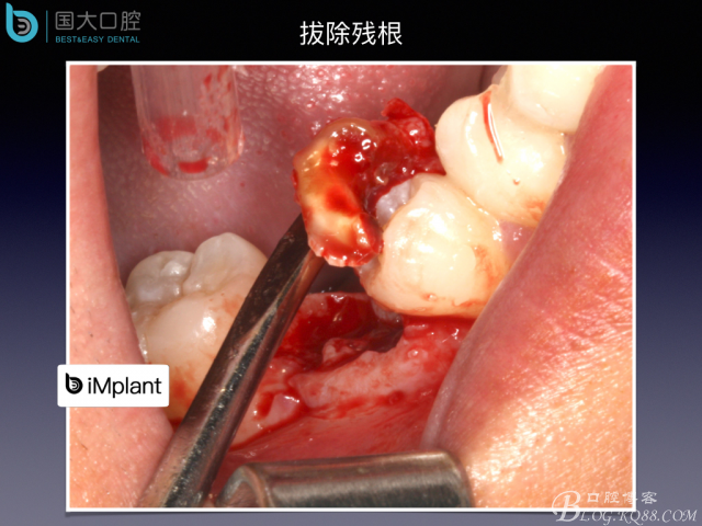 20160806124137_85165.jpeg 20160806124137_85165.jpeg