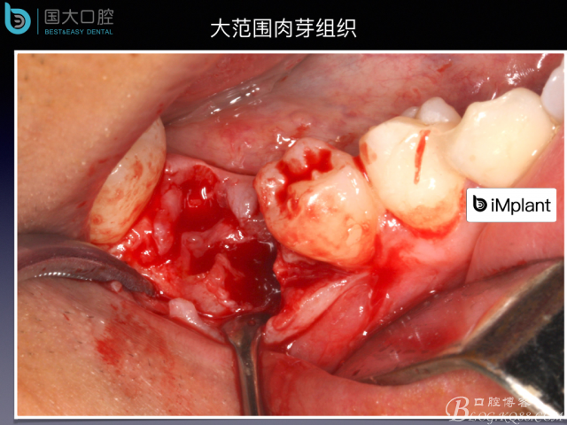 20160806124141_82227.jpeg 20160806124141_82227.jpeg