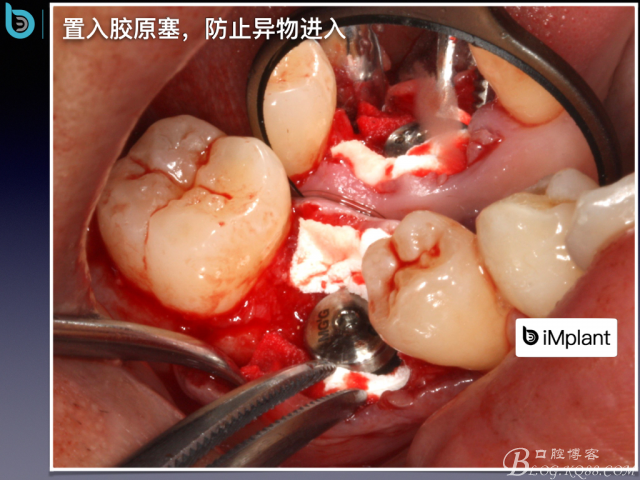 20160806124208_89344.jpeg 20160806124208_89344.jpeg