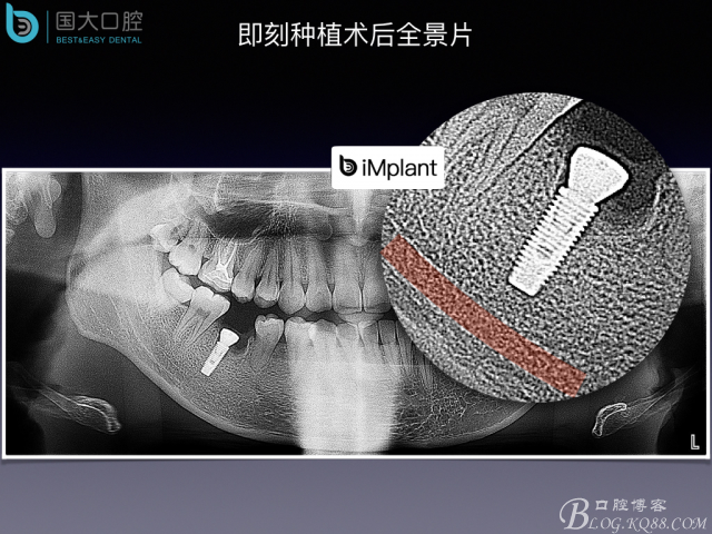 20160806124216_56463.jpeg 20160806124216_56463.jpeg