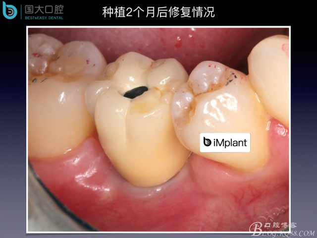 20160806124230_91054.jpeg 20160806124230_91054.jpeg