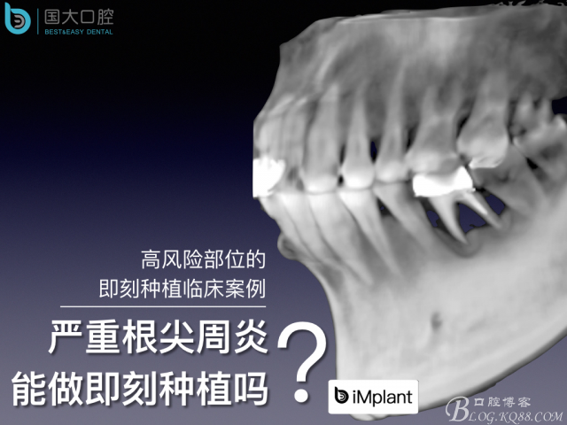 20160715154342_75439.jpeg 20160715154342_75439.jpeg