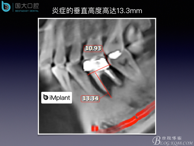 20160715154351_18164.jpeg 20160715154351_18164.jpeg