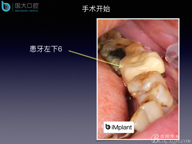 20160715154357_64018.jpeg 20160715154357_64018.jpeg