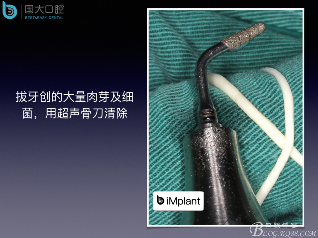 20160715154401_31047.jpeg 20160715154401_31047.jpeg