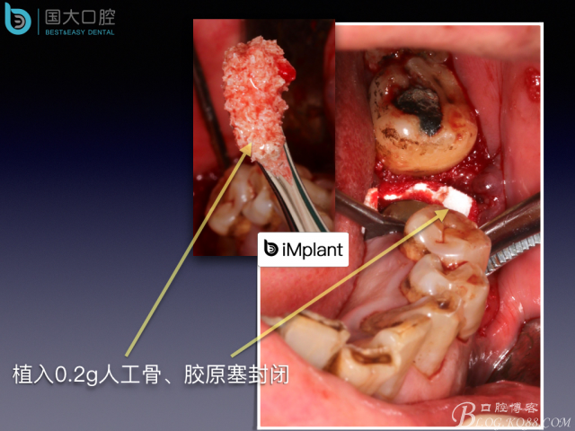 20160715154501_26005.jpeg 20160715154501_26005.jpeg