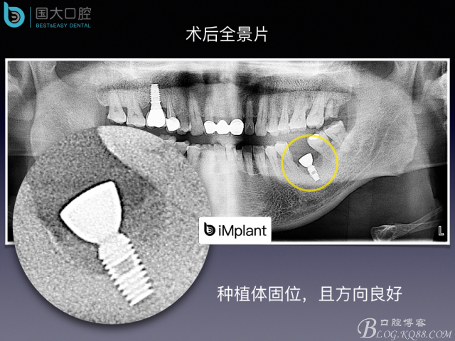 20160715154505_85635.jpeg 20160715154505_85635.jpeg