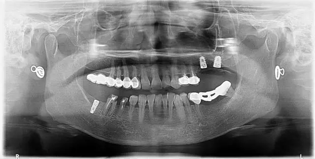 640.webp (8).jpg 640.webp (8).jpg