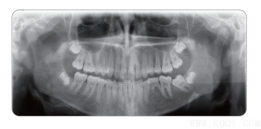 2012455444165069.jpg 2012455444165069.jpg