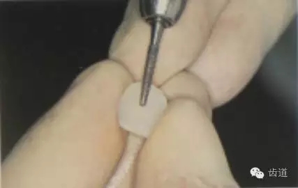 瓷貼面的粘接步驟及技術(shù)要點(diǎn) 瓷貼面的粘接步驟及技術(shù)要點(diǎn)