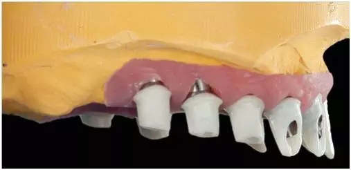 640.webp (16).jpg 640.webp (16).jpg