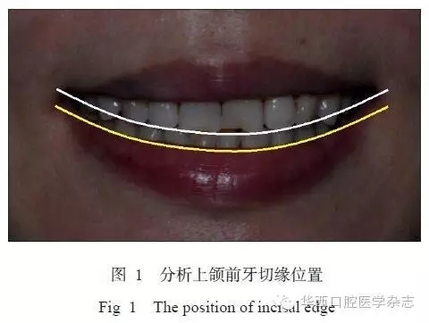 640.webp.jpg 640.webp.jpg