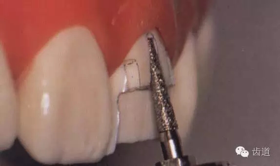 640.webp (3).jpg 640.webp (3).jpg