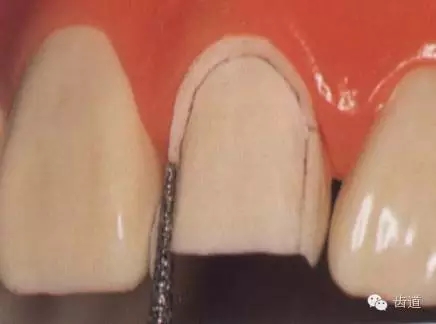 640.webp (9).jpg 640.webp (9).jpg