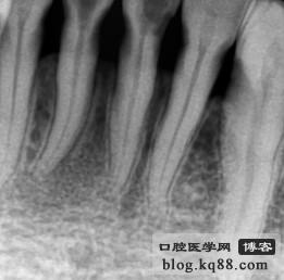 1347350542673193199.jpg 1347350542673193199.jpg