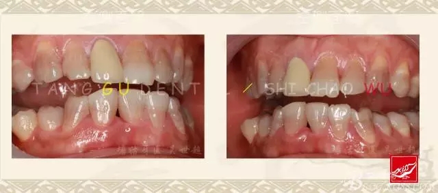 640.webp (6).jpg 640.webp (6).jpg