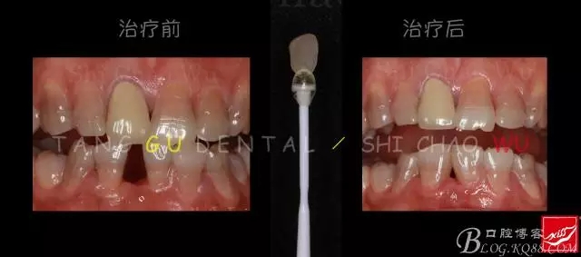 640.webp (7).jpg 640.webp (7).jpg