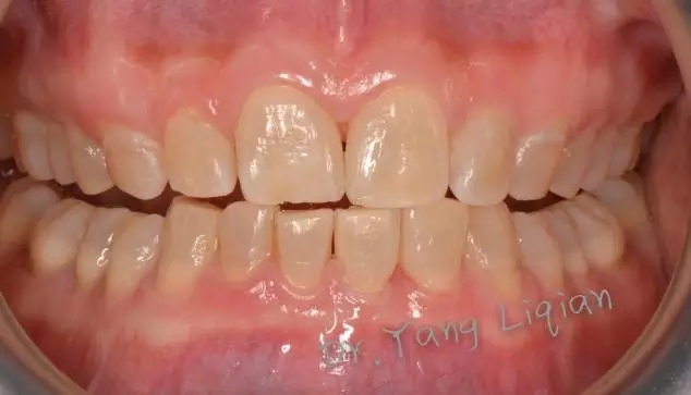 640.webp (11).jpg 640.webp (11).jpg