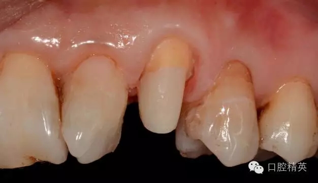 640.webp (3).jpg 640.webp (3).jpg