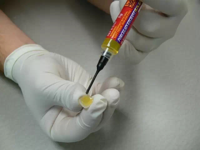 貼面粘接操作流程及要點(diǎn) 貼面粘接操作流程及要點(diǎn)