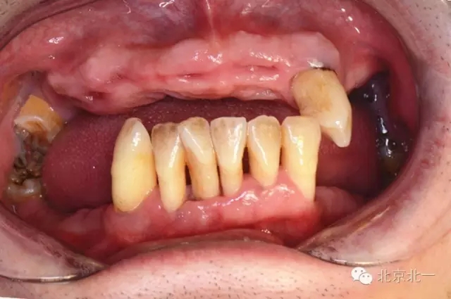 640.webp.jpg 640.webp.jpg