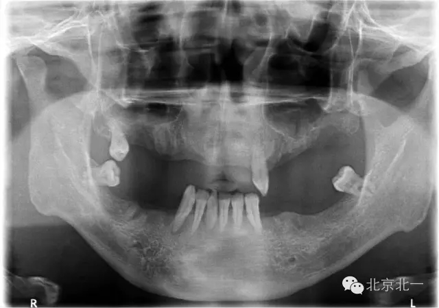 640.webp (1).jpg 640.webp (1).jpg